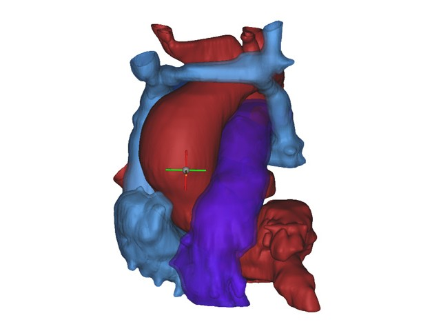 case0016