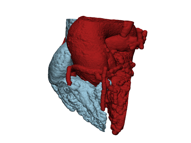 case0096