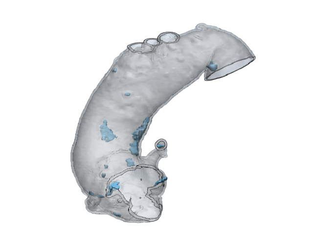 case0107