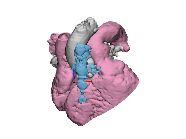 case0115