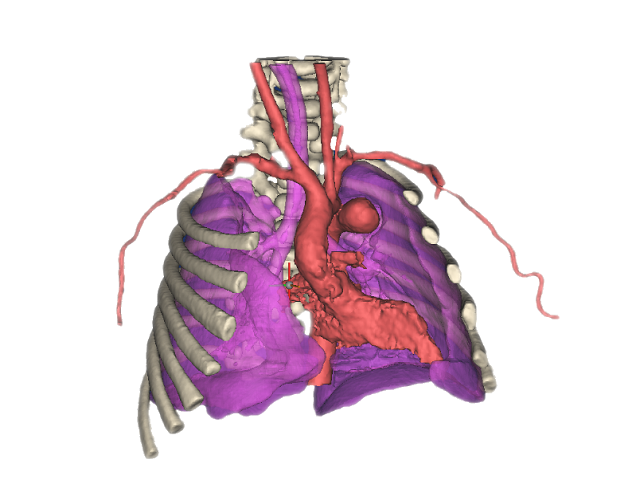 case0026