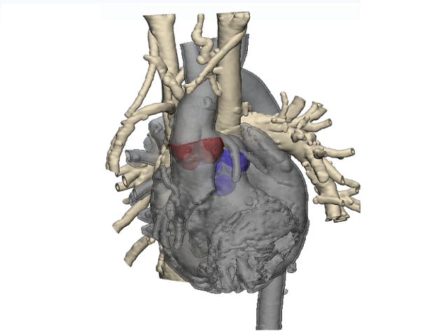 case0058